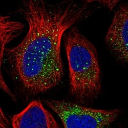 PUSL1 Antibody, Novus Biologicals 0.1mL; Unlabeled:Antibodies, Polyclonal
